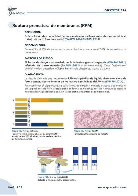 Ruptura prematura de membranas 