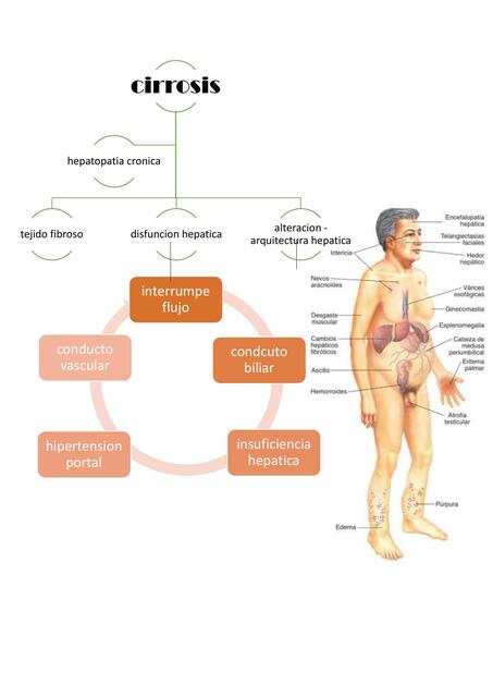 Cirrosis 