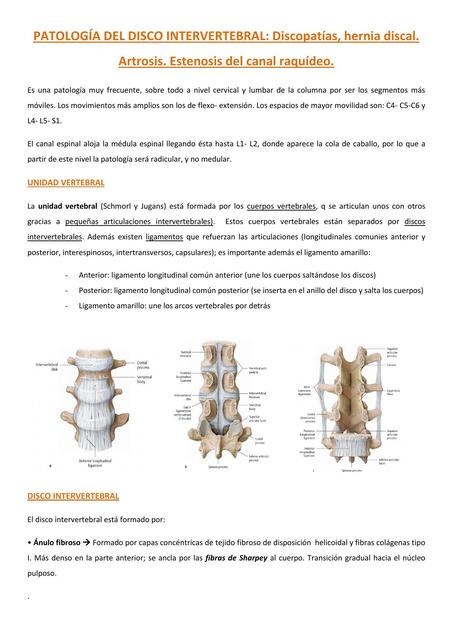 Patología del disco intervertebral: Discopatías, hernia discal. Artrosis. Estenosis del canal raquídeo