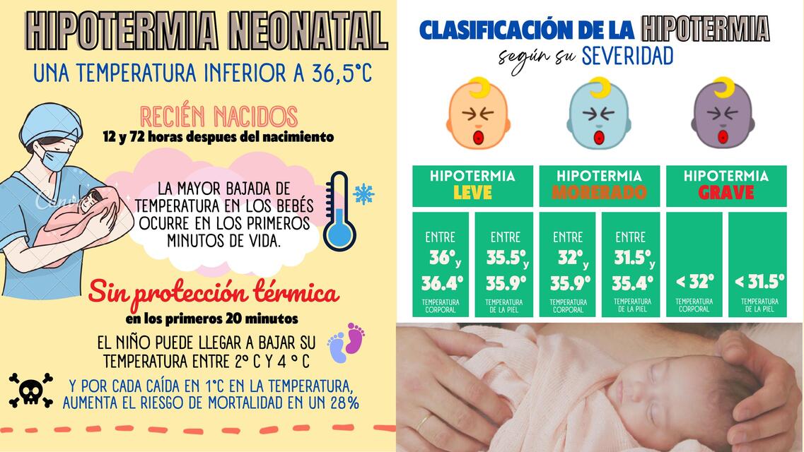 Hipotermia neonatal 