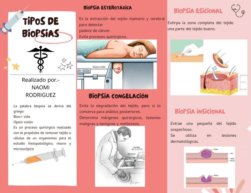 Tipos de biopsias 