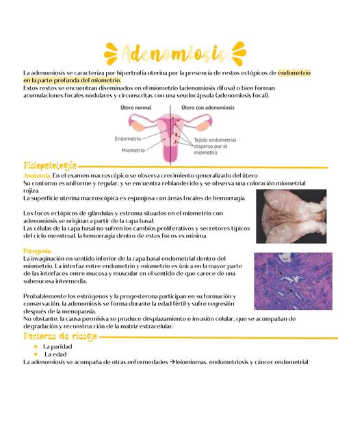 Adenomiosis