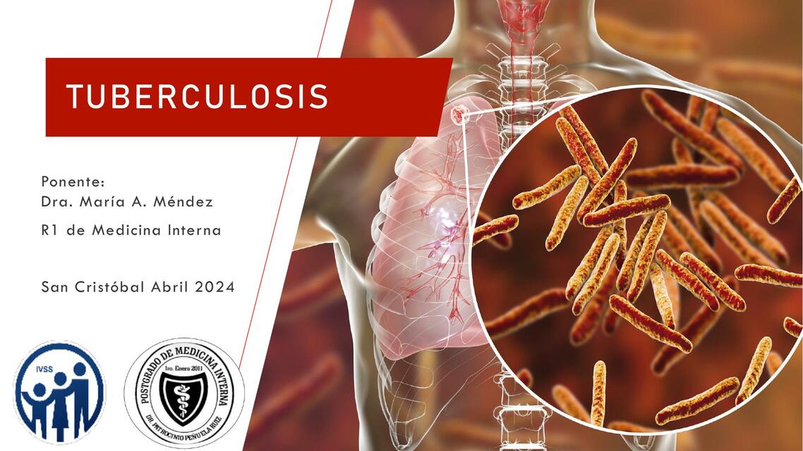 Tuberculosis 