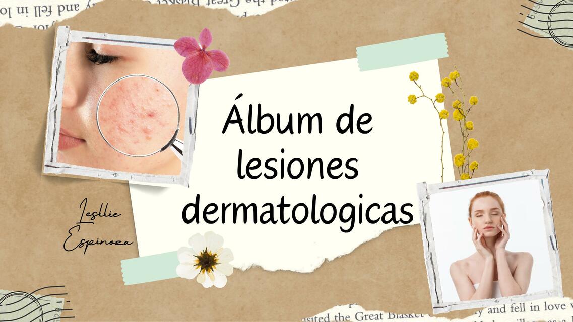 Álbum de lesiones dermatologicas