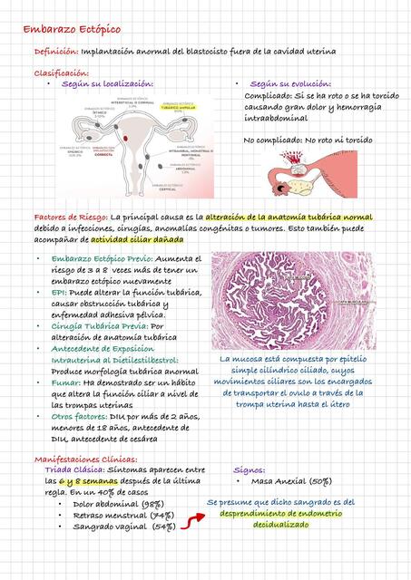 Embarazo Ectópico