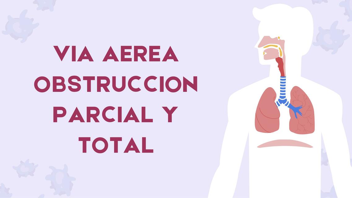 Obstrucción de la vía aérea 