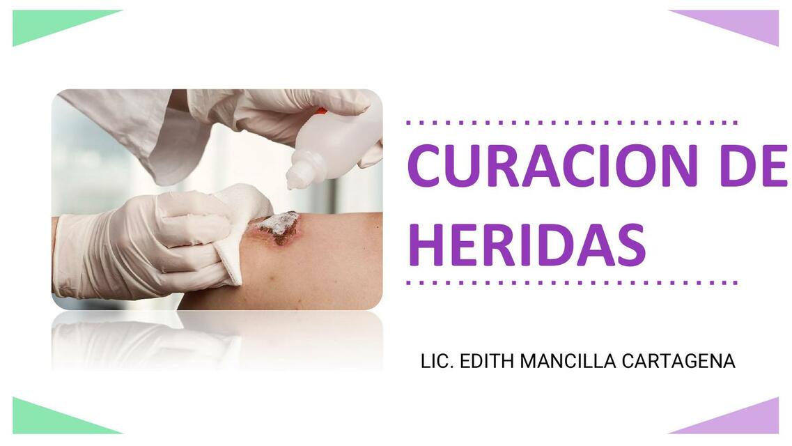 Curacion de heridas