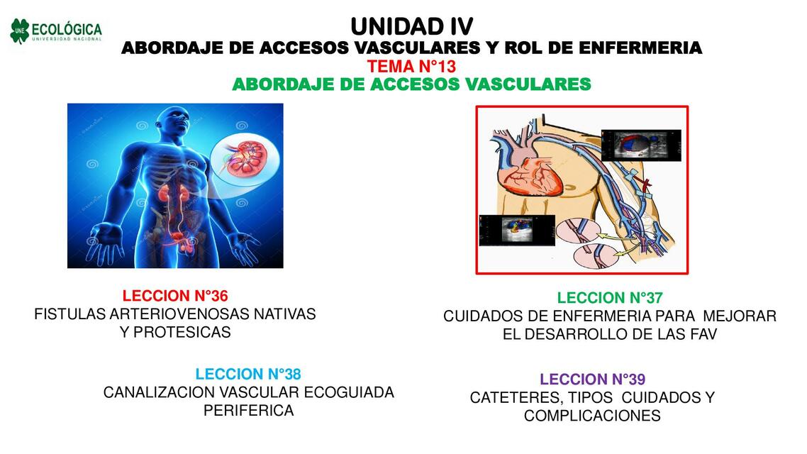 Accesos vasculares 