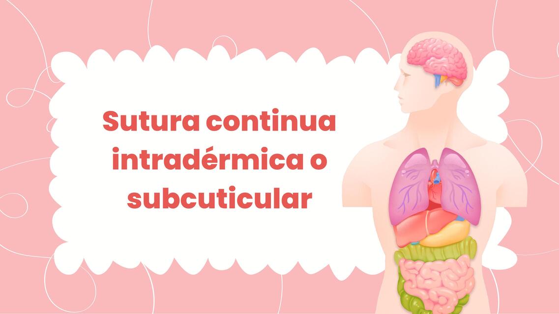 Sutura continua intradérmica o subcuticular  