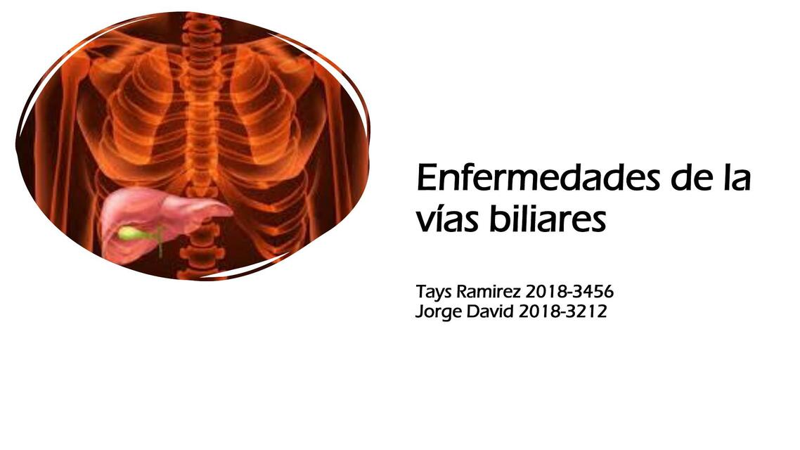 Enfermedades de la vías biliares 