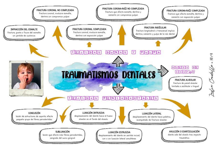 TRAUMATISMOS DENTALES ODONTOPEDIATRÍA Y SU CLASIFICACIÓN SEGÚN EL TIPO DE TEJIDO.