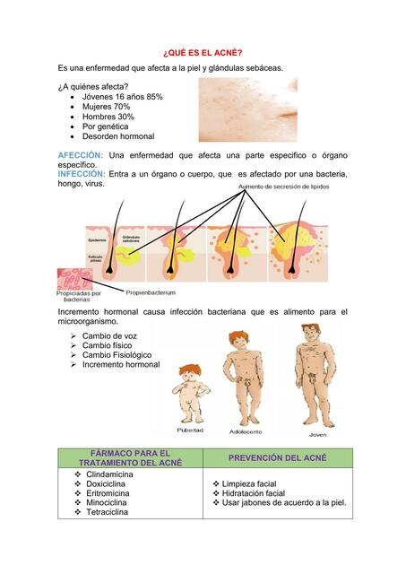 ¿Qué es el Acné?