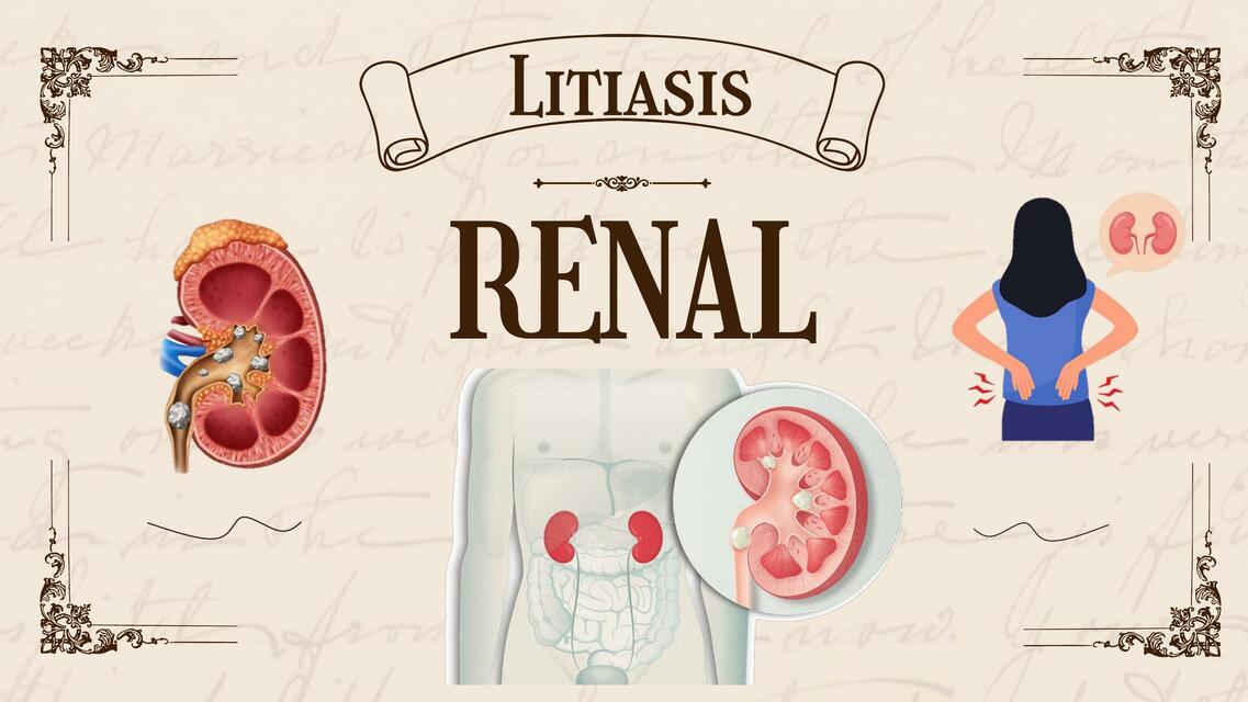 Litiasis renal