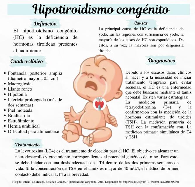 Hipotiroidismo congénito