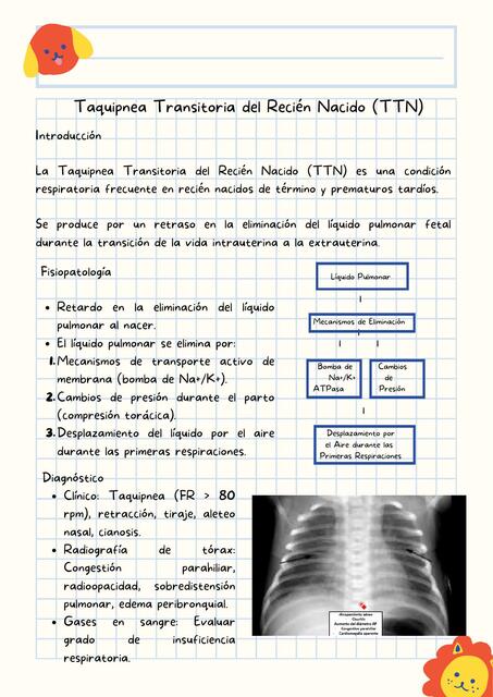 Taquipnea Transitoria del Recién Nacido TTN