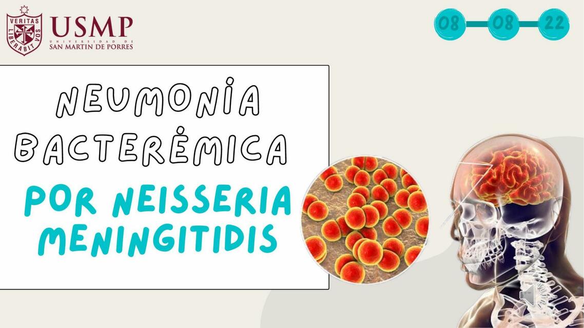 Neumonía Bacterémica por Neisseria Meningitis 