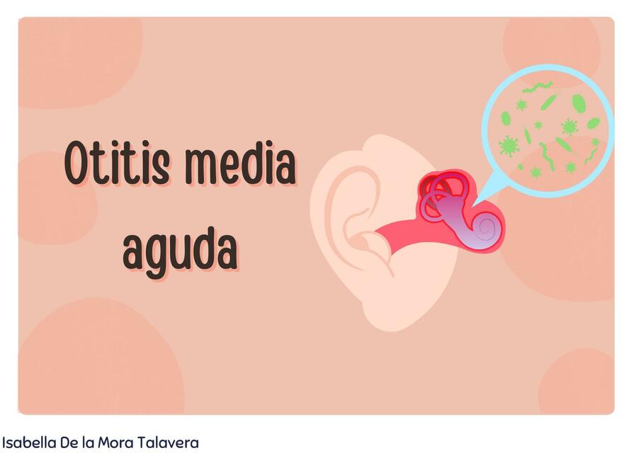 Otitis media aguda