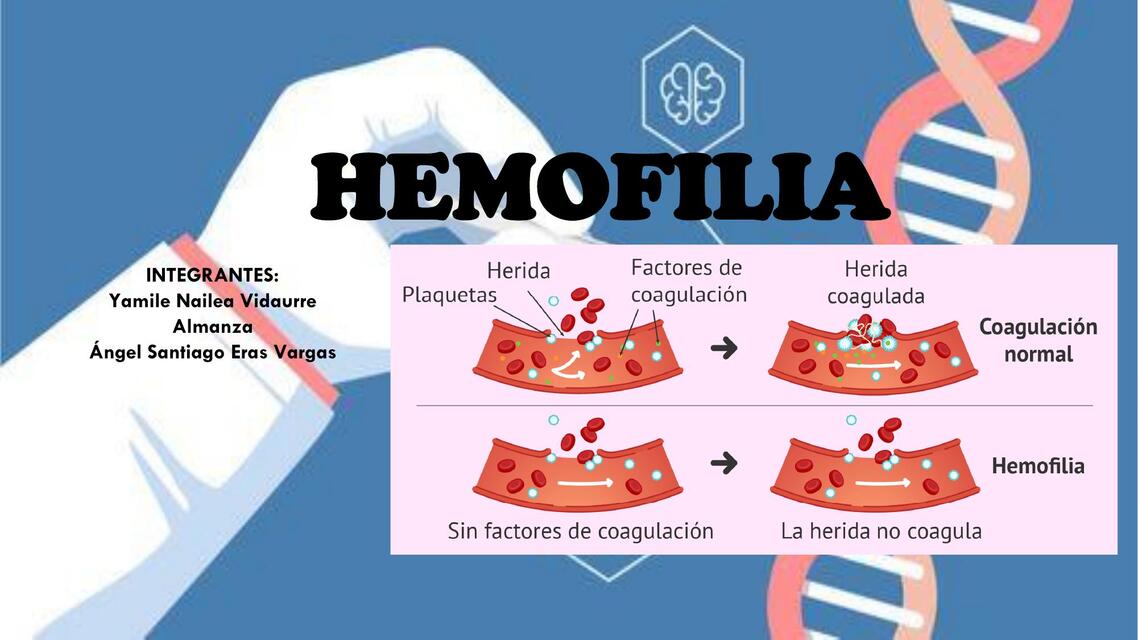 Hemofilia 