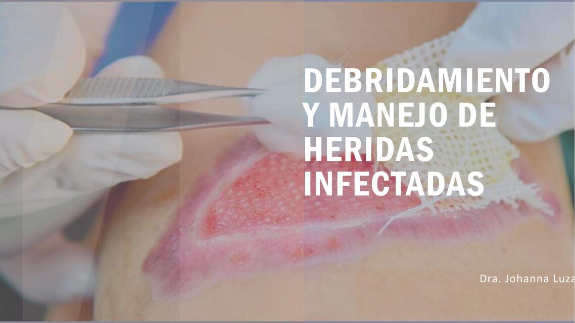 Debridamiento y manejo de heridas infectadas 