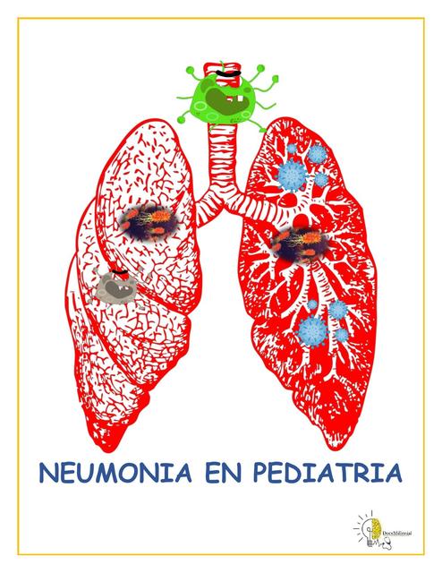 RESUMEN NEUMONIA PEDIATRIA