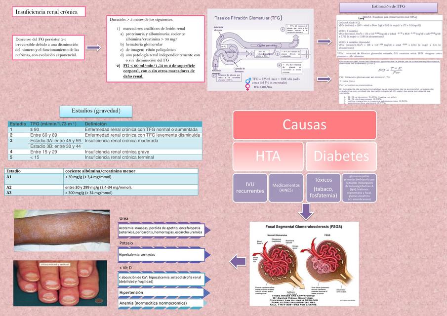 Insuficiencia Renal Crónica Andrea Oviedo Urzúa Udocz