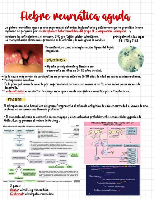 Fiebre Reumática Aguda Lena Udocz