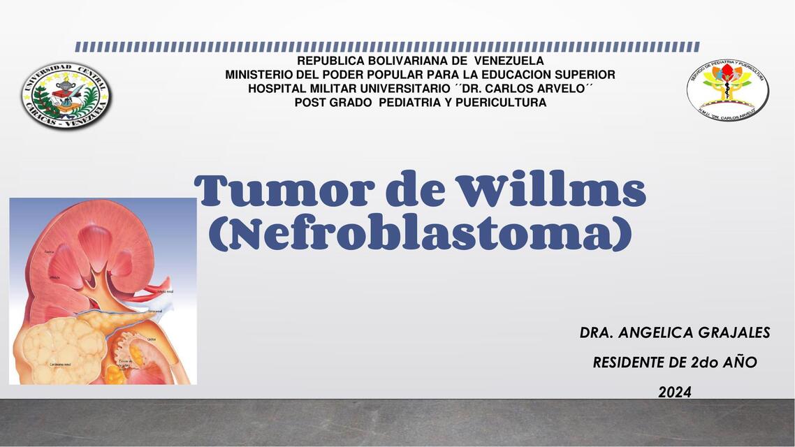 Tumor de Wilms 