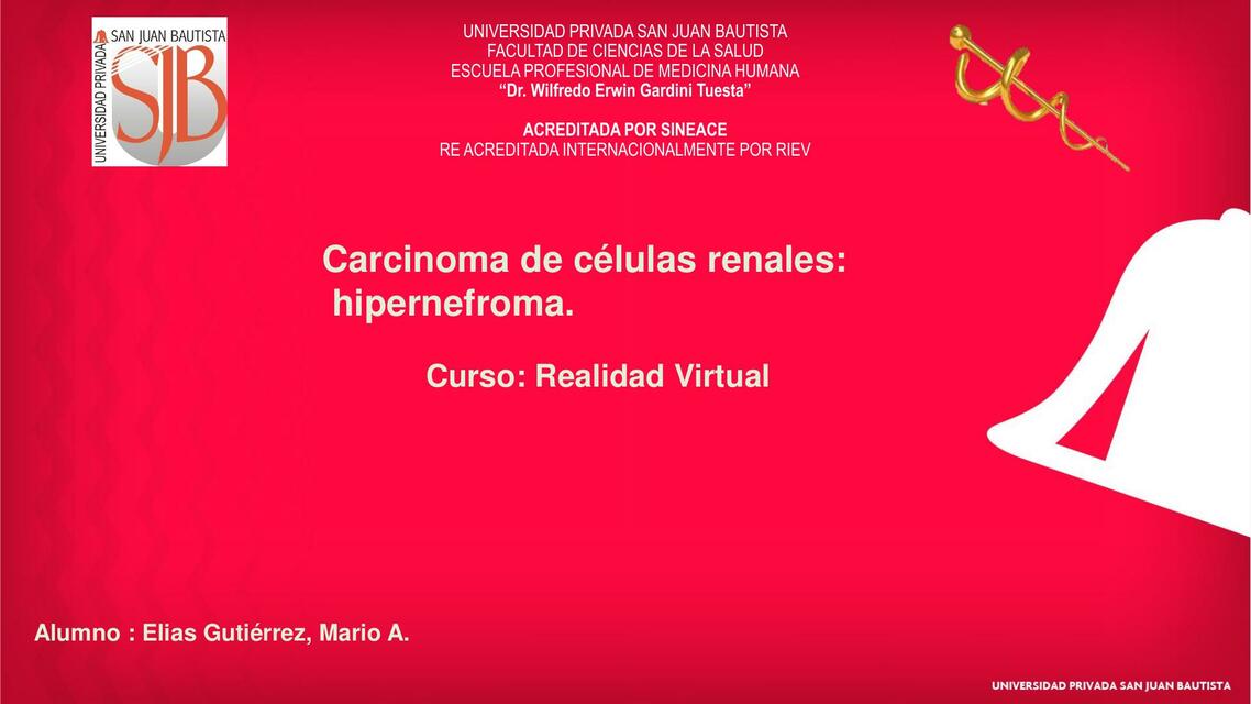 Carcinoma de células renales: hipernefroma