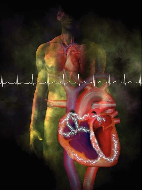 El electrocardiograma  de 12 derivaciones