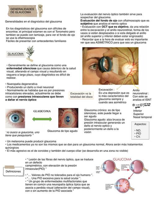 Glaucoma y Tonometria