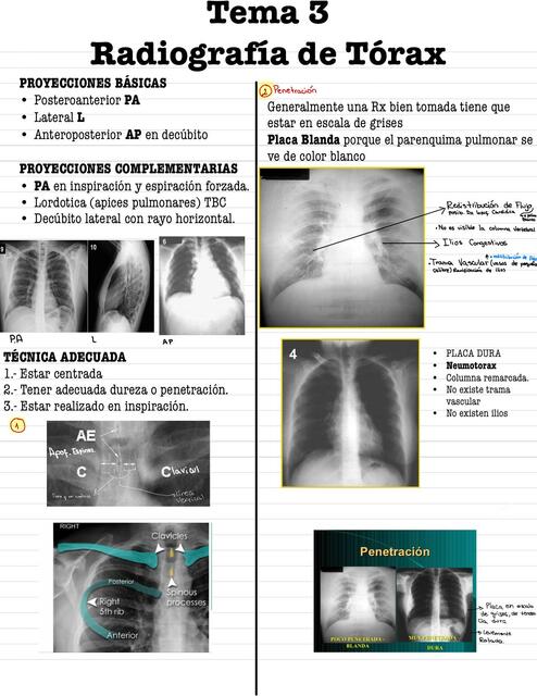 Radiografía de Tórax