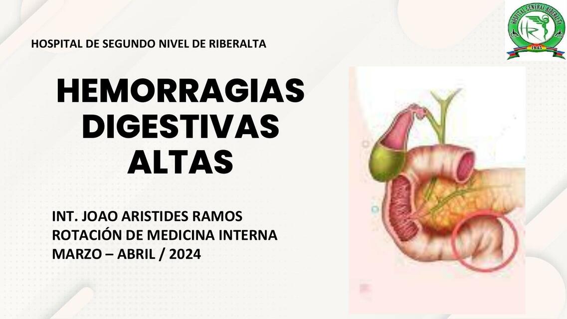 Hemorragias Digestivas Altas 