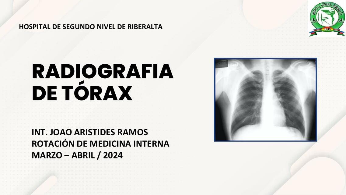 Radiografía de Tórax 