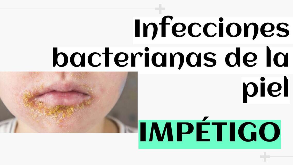 Infecciones bacterianas de la piel impétigo 