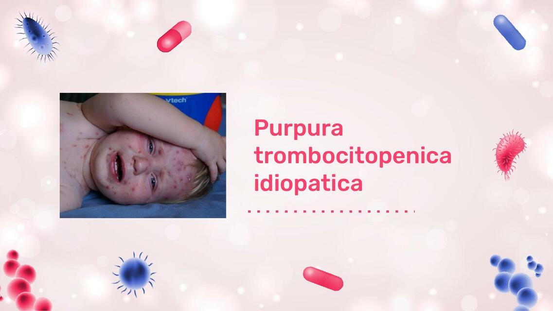 Purpura Trombocitopénica Idiopática 