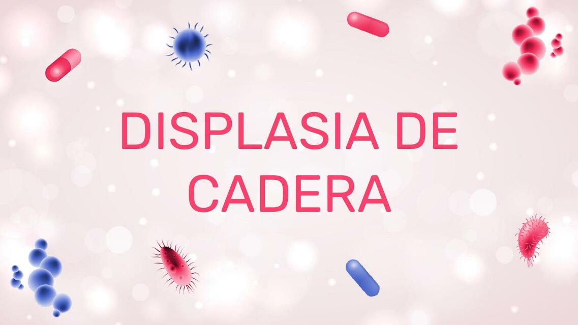 DISPLASIA DE CADERA Y PIE PLANO-PEDIATRIA