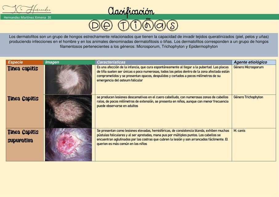 Clasificación de tiñas  