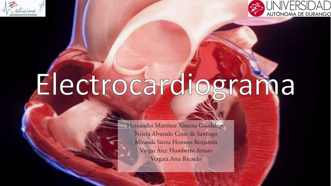 Electrocardiograma II