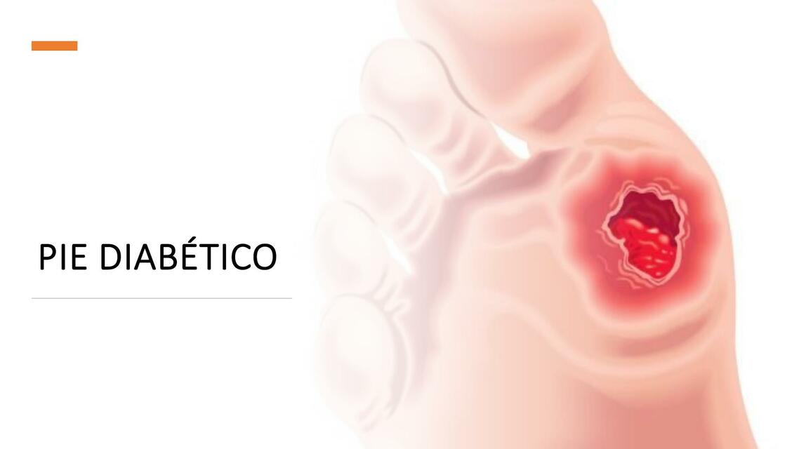Pie Diabético Paguiel Olmos uDocz