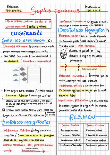 Soplos Cardiacos