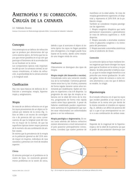 Ametropías y su corrección- Oftalomología