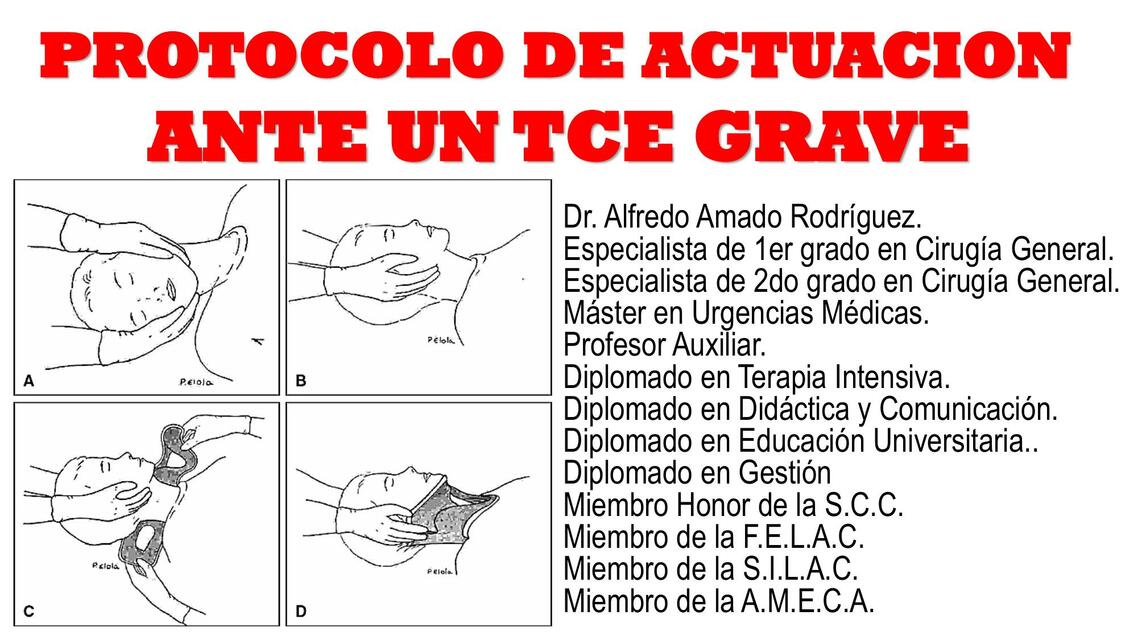 Protocolo de actuación ante un TCE grave 