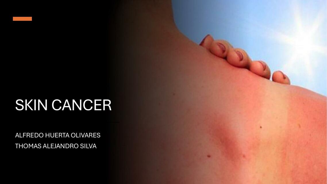 Skin Cáncer 