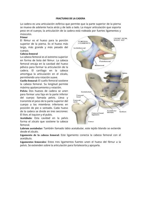 Fracturas de la cadera 