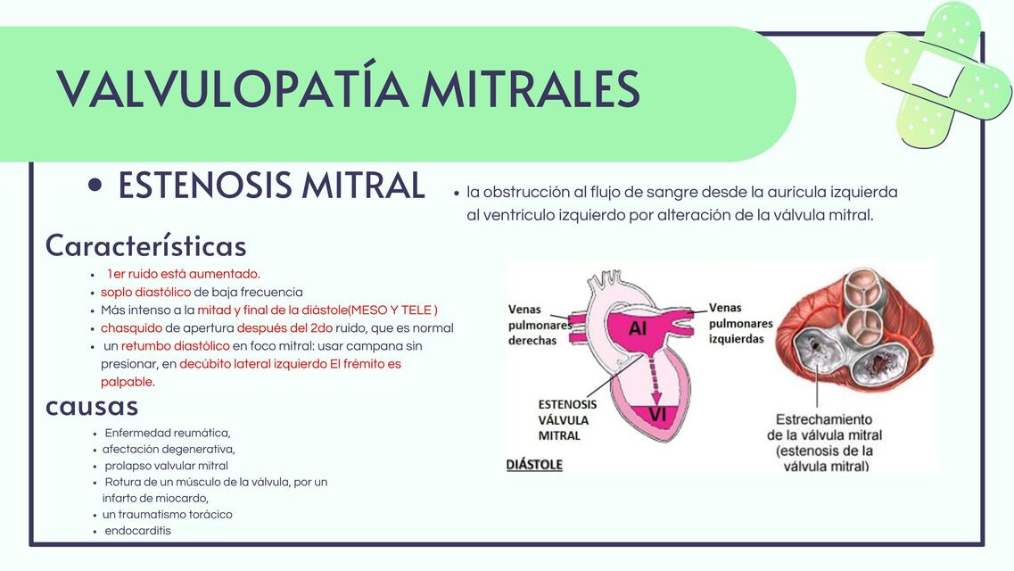 Valvulopatias mitrales 