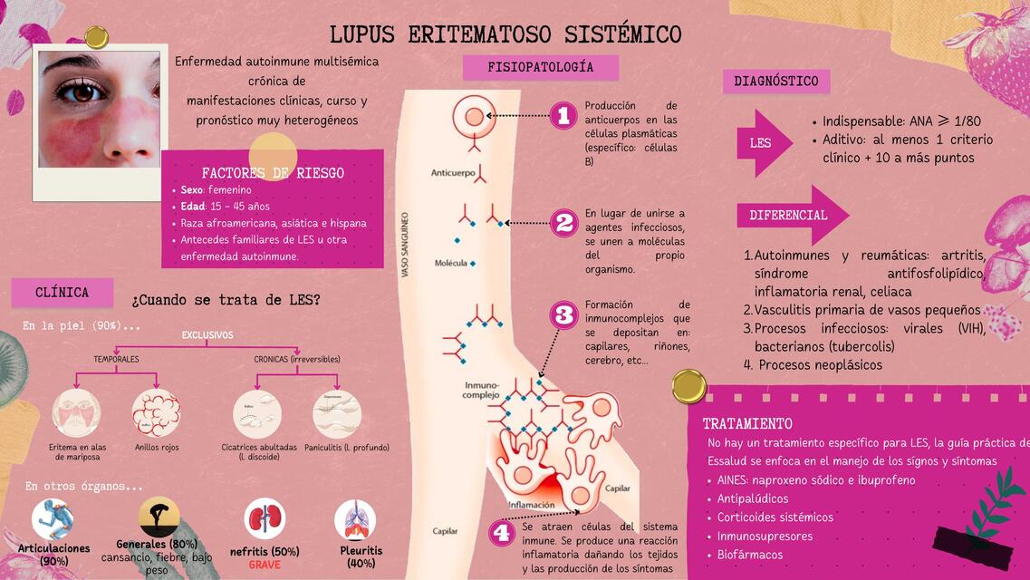 Lupus eritematoso sistémico 