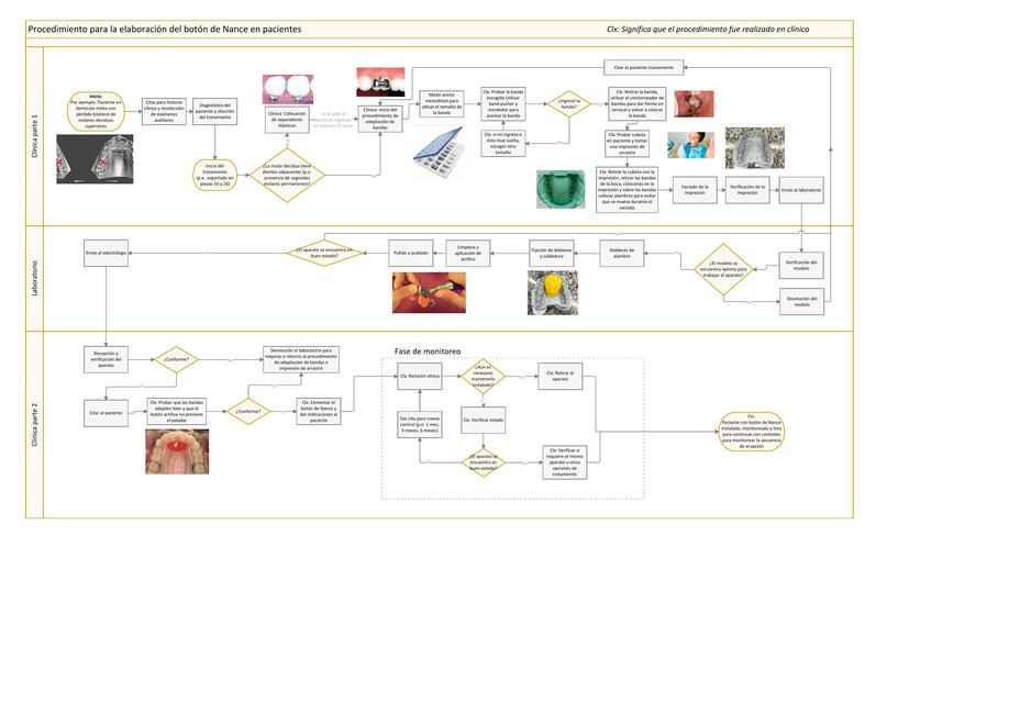 Procedimiento para la elaboración del botón de Nance en pacientes  