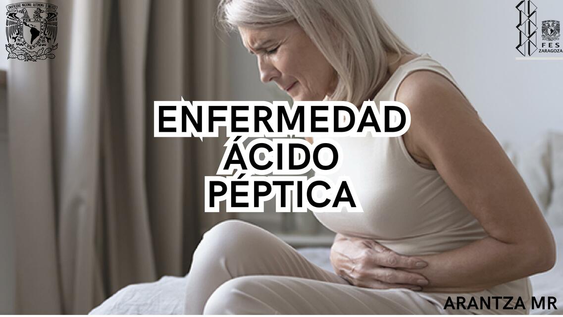 Enfermedad ácido péptica