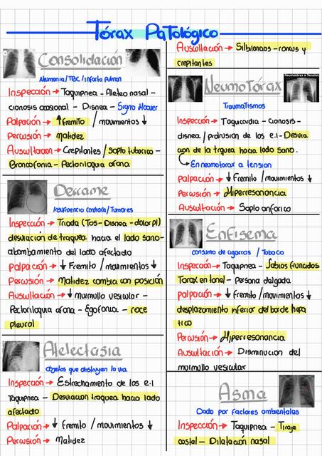 Sindromes Pleuropulmonares