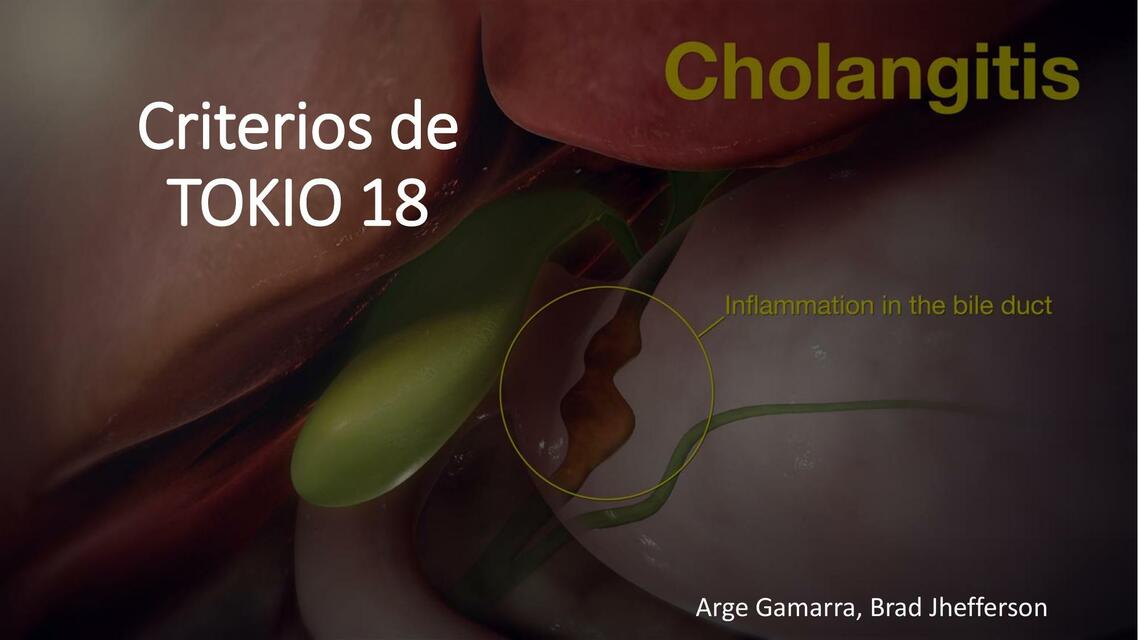 Criterios de tokio 18 colangitis